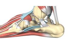 Ankle Ligament Reconstruction